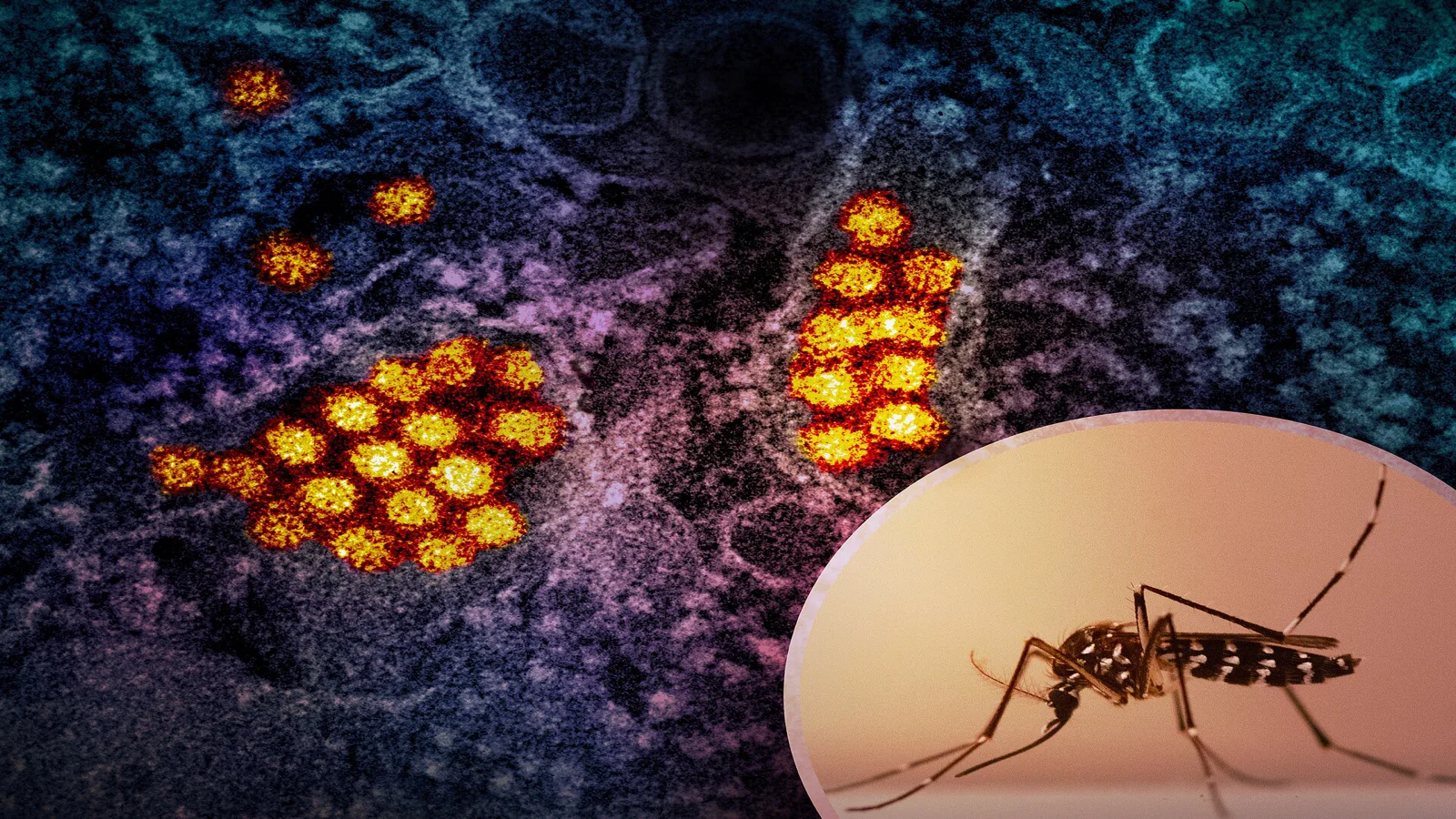 Montagem com partículas do vírus da dengue vistas ao microscópio eletrônico, em cores artificiais, e um mosquito Aedes em destaque no canto (imagem de arquivo)